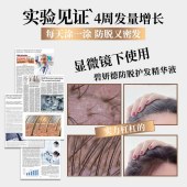 植物防脱精华液 草本养发发际线修护强韧发根育发液